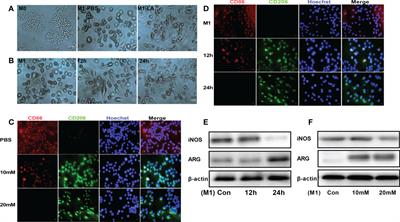 Lactate-driven macrophage polarization in the inflammatory microenvironment alleviates intestinal inflammation